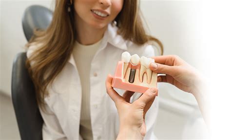 Dental Implants Beckenham .